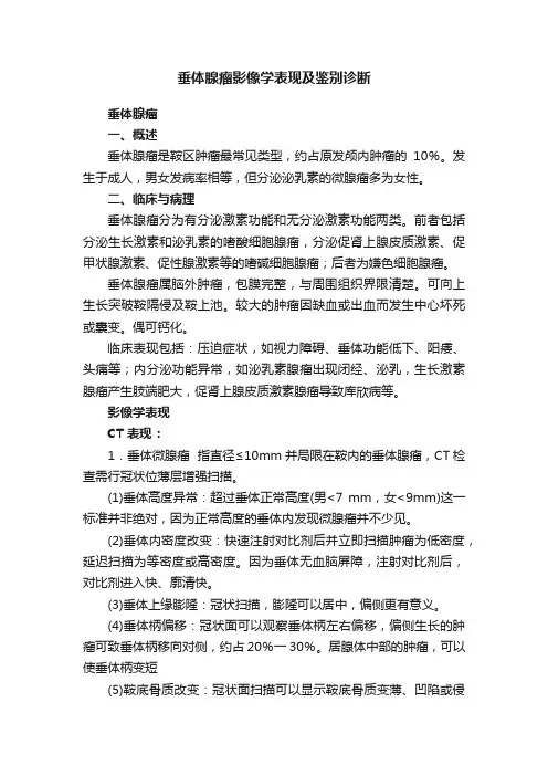 垂体腺瘤影像学表现及鉴别诊断