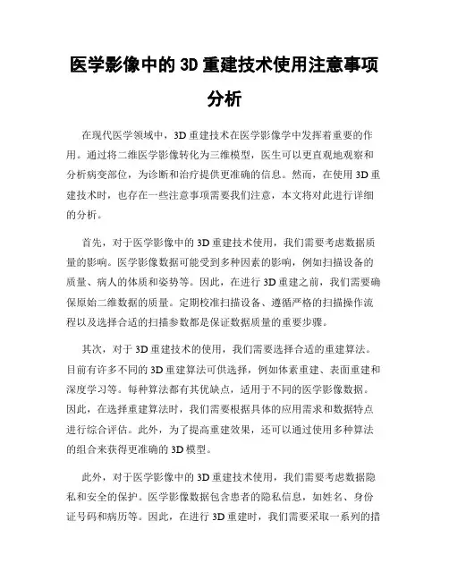 医学影像中的3D重建技术使用注意事项分析
