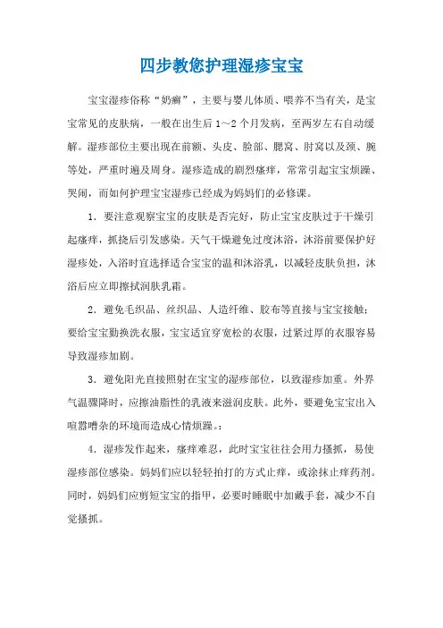 四步教您护理湿疹宝宝