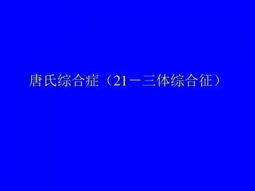 儿科14--21-三体综合征(唐氏综合症)