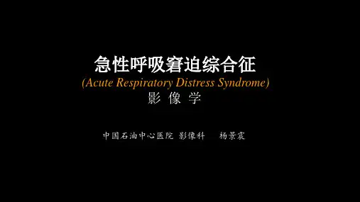 急性呼吸窘迫综合征(ARDS)的 影像学表现