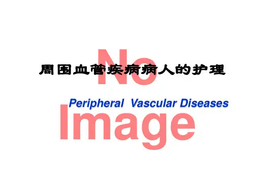 周围血管疾病病人护理  ppt课件