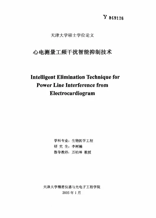 心电测量工频干扰智能抑制技术