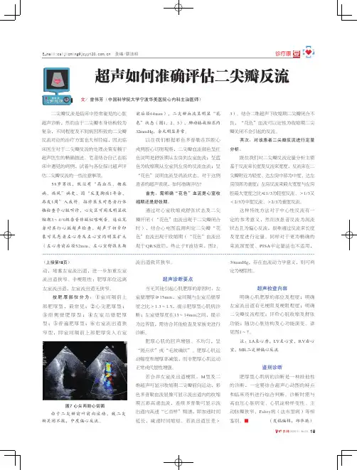 超声如何准确评估二尖瓣反流