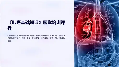 《肺癌基础知识》医学培训课件