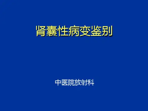 囊性肾癌(课件)