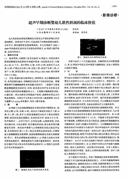 超声早期诊断婴幼儿肌性斜颈的临床价值