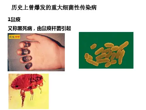 5历史上爆发的细菌性传染病解析