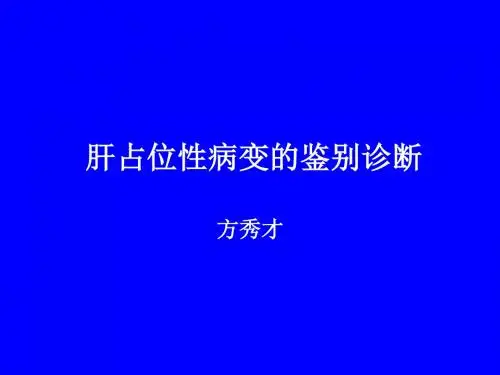 肝占位性病变的鉴别诊断