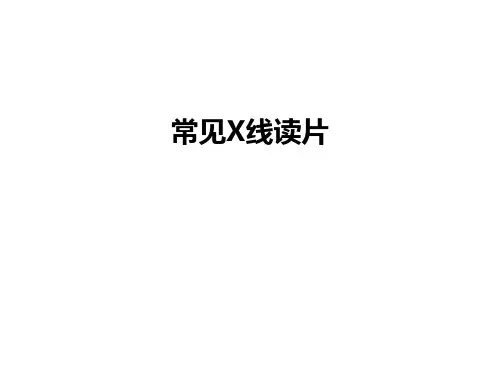 最新常见X线读片