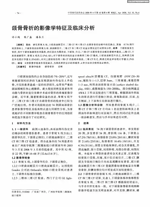 颌骨骨折的影像学特征及临床分析