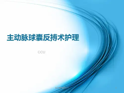主动脉球囊反搏术护理  ppt课件