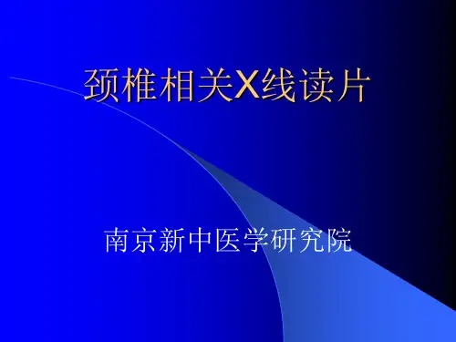 (完整版)颈椎影像诊断