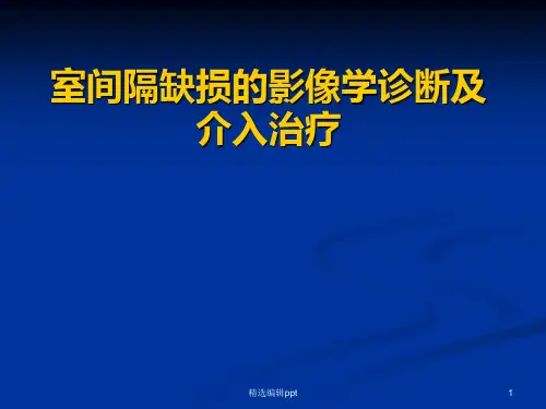 室间隔缺损的影像学诊断及介入治疗ppt课件