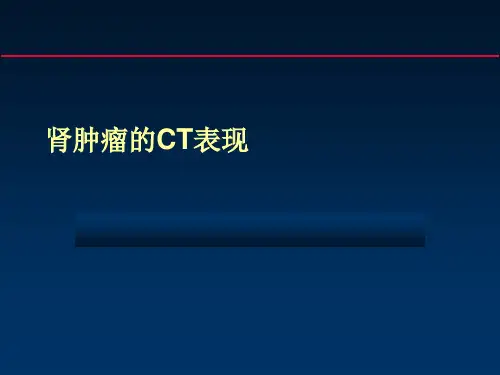 肾肿瘤的CTPPT课件