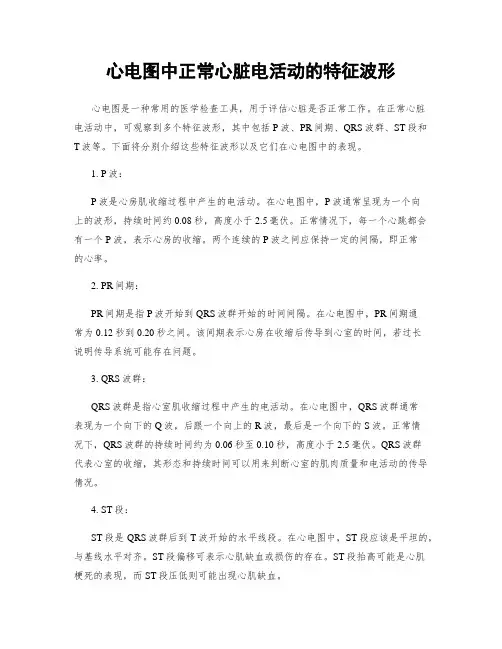 心电图中正常心脏电活动的特征波形