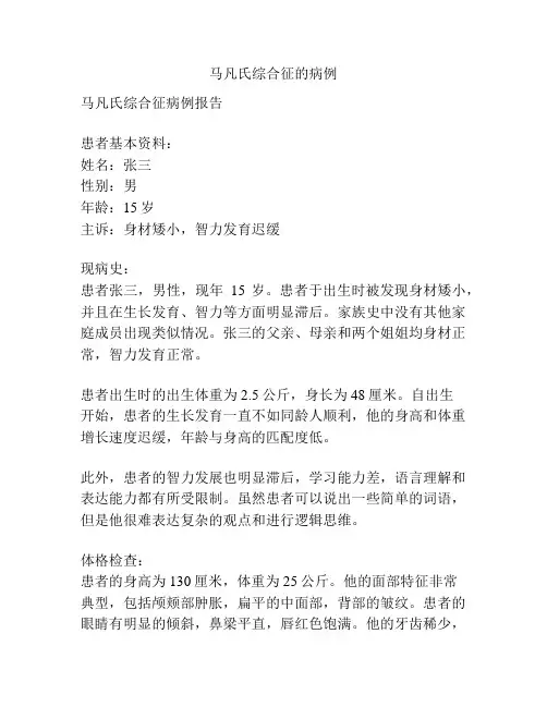 马凡氏综合征的病例