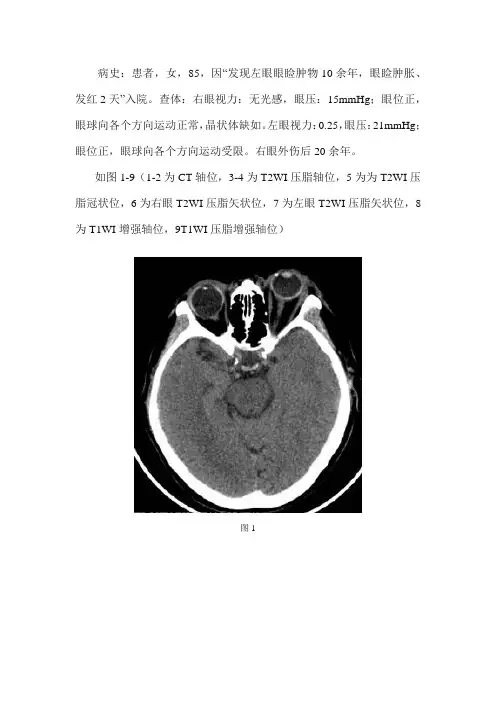 左侧眼球突出影像诊断及鉴别诊断--眶尖综合征、视神经萎缩、球后蜂窝组织炎、无晶体眼