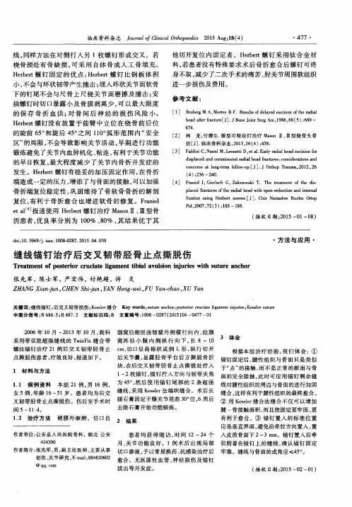 缝线锚钉治疗后交叉韧带胫骨止点撕脱伤