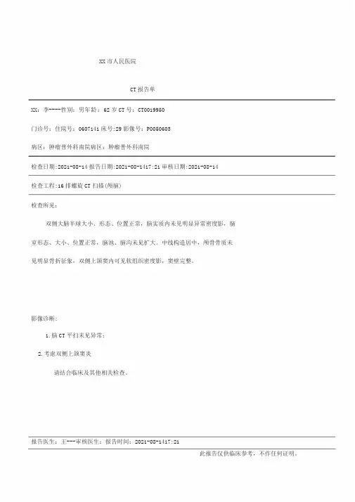 CT检查报告单头颅