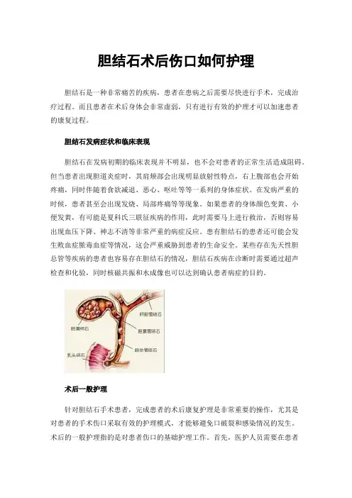 胆结石术后伤口如何护理
