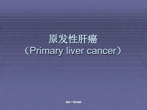 内科原发性肝癌PPT课件