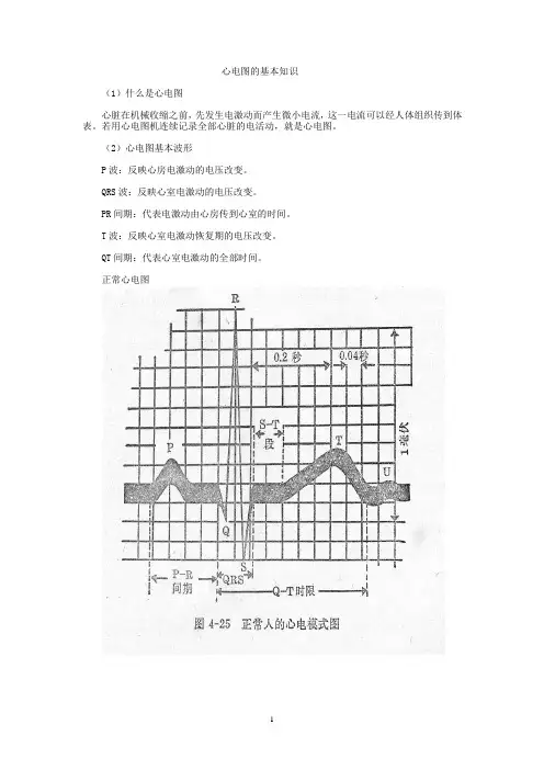 心电图的基本知识(有图)