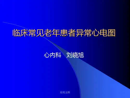 常见异常心电图诊断最新版本