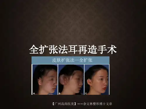全扩张法耳再造手术