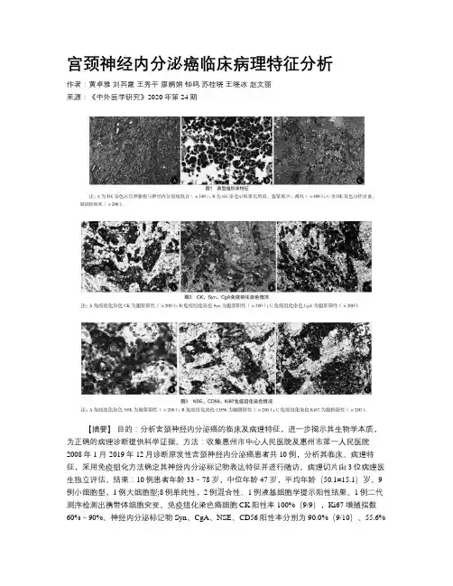 宫颈神经内分泌癌临床病理特征分析