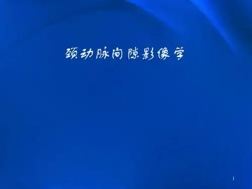 颈动脉间隙肿瘤影像学表现及鉴别ppt课件