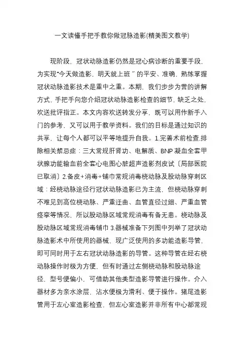 一文读懂手把手教你做冠脉造影(精美图文教学)