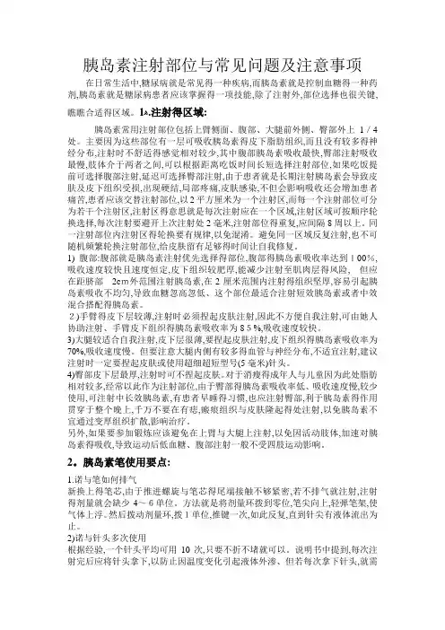 胰岛素注射部位和常见问题及注意事项