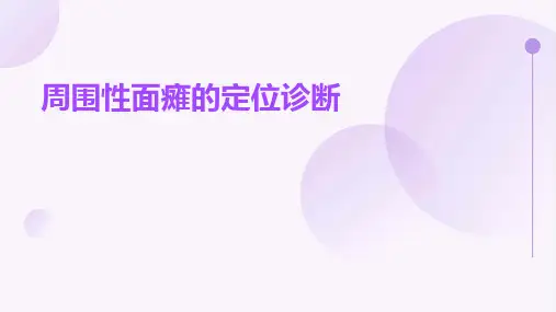 周围性面瘫的定位诊断