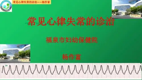 常见心律失常的诊治