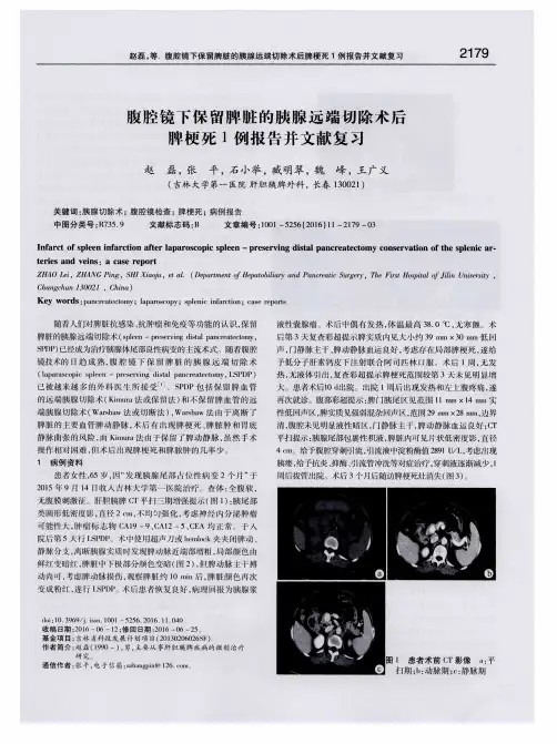腹腔镜下保留脾脏的胰腺远端切除术后脾梗死1例报告并文献复习