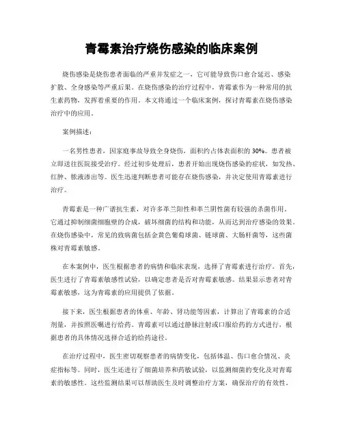 青霉素治疗烧伤感染的临床案例