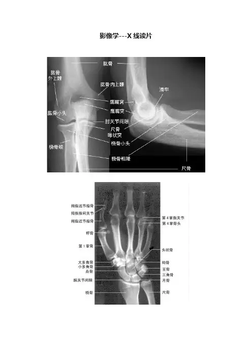 影像学---X线读片