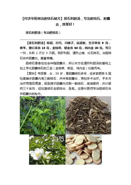 【付济华医师治胆结石秘方】排石利胆汤，专治胆结石、胆囊炎，效果好！