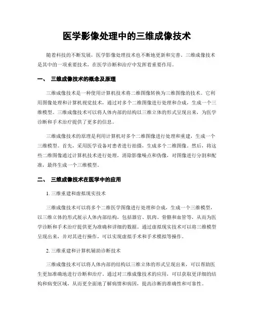 医学影像处理中的三维成像技术