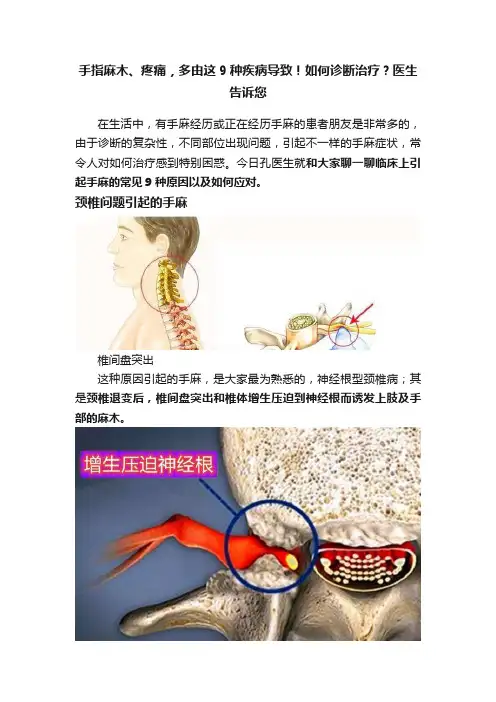 手指麻木、疼痛，多由这9种疾病导致！如何诊断治疗？医生告诉您
