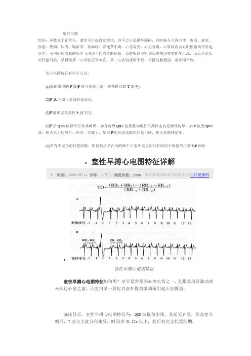 室性早搏心电图特征详解