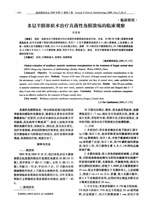 多层羊膜移植术治疗真菌性角膜溃疡的临床观察