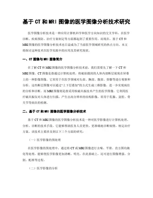 基于CT和MRI图像的医学图像分析技术研究