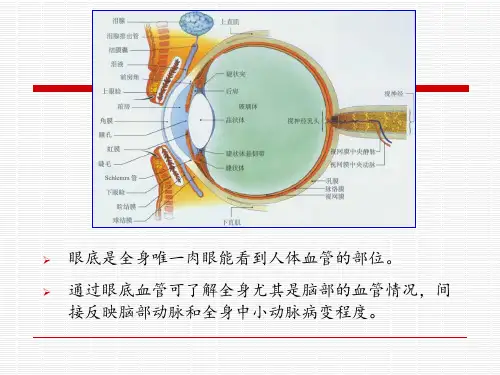 眼底照片解析ppt课件