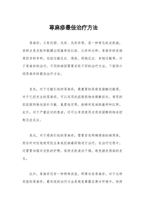 荨麻疹最佳治疗方法