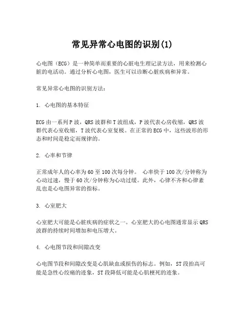 常见异常心电图的识别(1)