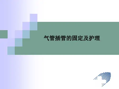 气管插管的固定及护理