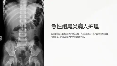 急性阑尾炎病人护理