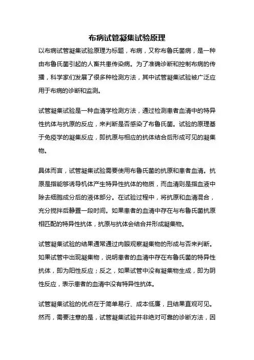 布病试管凝集试验原理